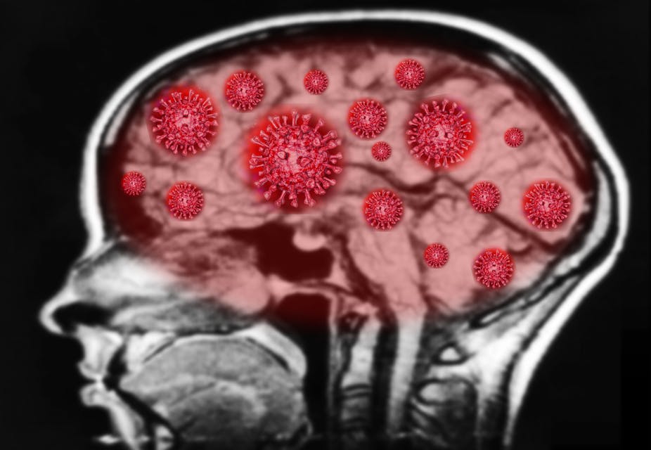 An x-ray of a head with red virus cells overlayed